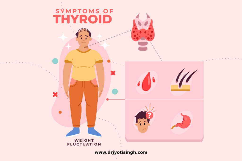 Thyroid Health